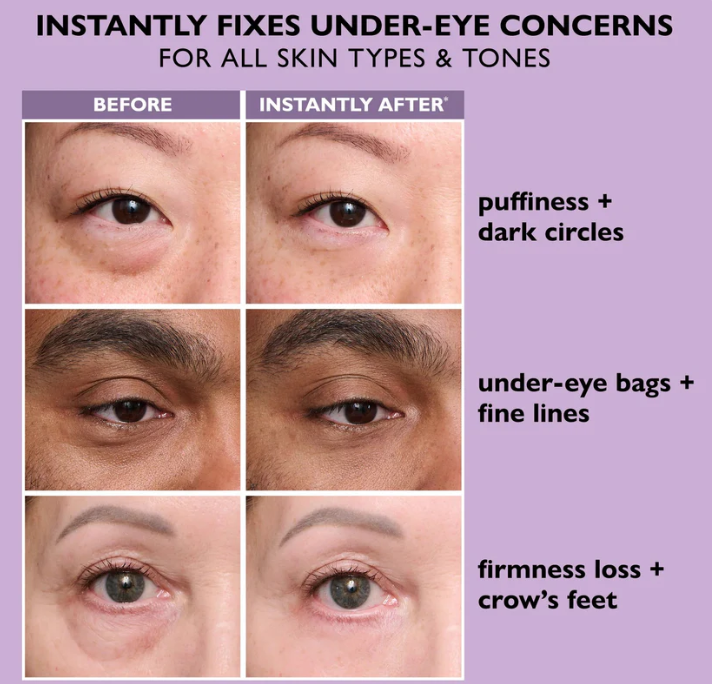 Instant Eye Tightener