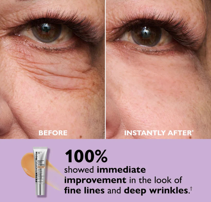 Instant Eye Tightener