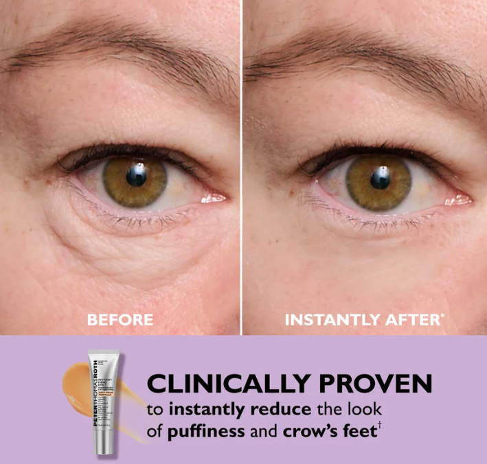 Instant Eye Tightener